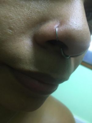 Steel Nose Hoop Customer Photo
